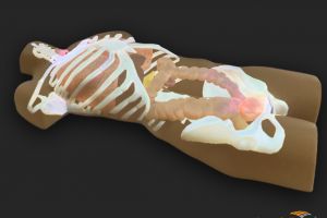 Research project “MedProjection”